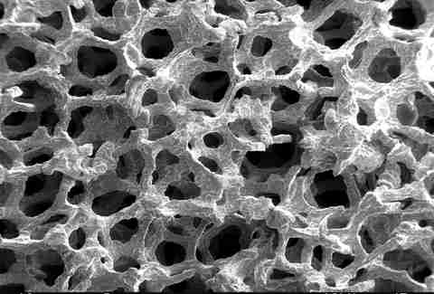 electron microscope