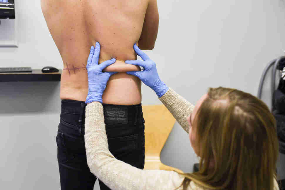 man getting fat frozen off