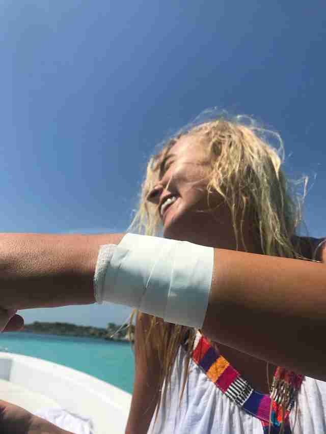 Woman holding up bandaged arm