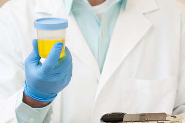 doctor holding urine sample