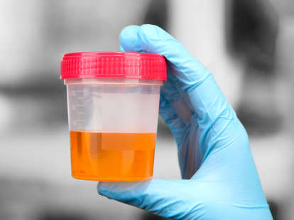 medical urine test