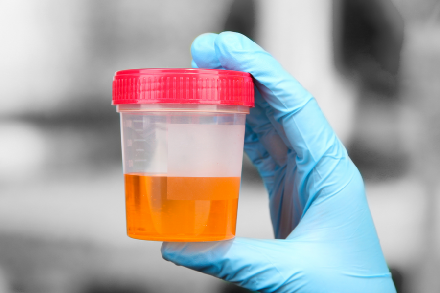 What Your Pee Says About Your Health - Thrillist