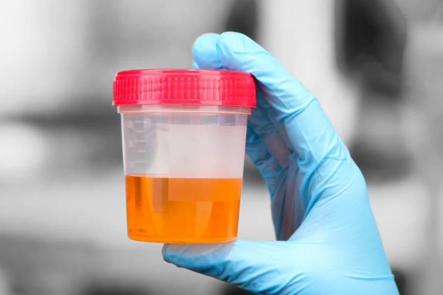 What Your Pee Says About Your Health Thrillist 