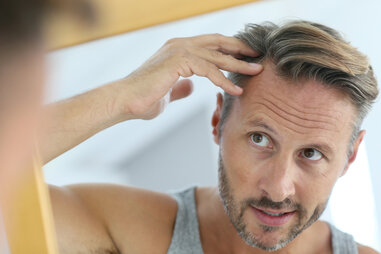 man with hair loss looking in mirror
