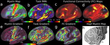 brain map myelin