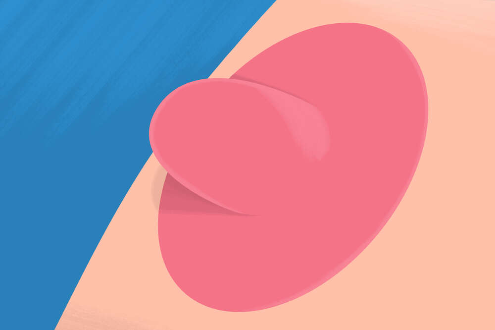 Nipples come in all different shapes, sizes, and colors! In fact, it's  possible to have a combination of two or more types. See all the
