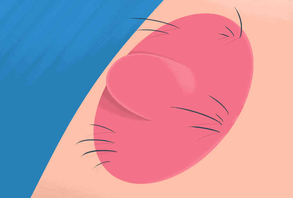 Big Black Bumpy Nipples - Different Types of Nipples, Explained (With IMAGES) - Thrillist