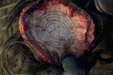 westworld head scalp map