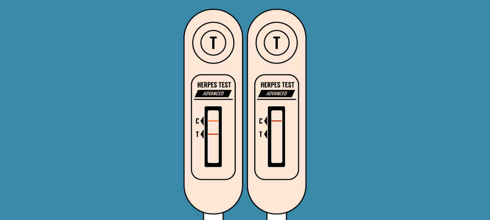 Genital herpes test virus sex association