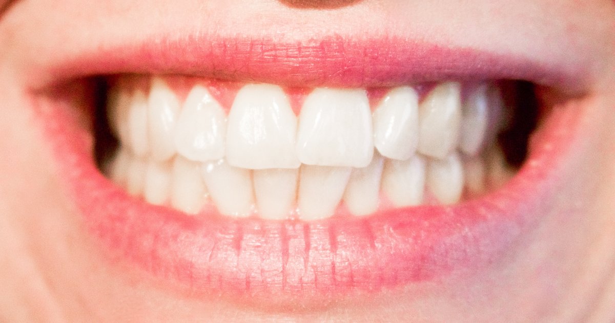 New Pill for Cavity Filling Heals Teeth Without Dentist Drill - Thrillist