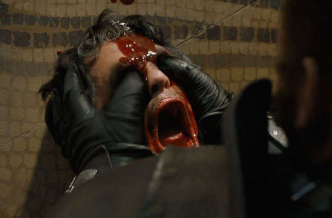 gross tv moments - game of thrones eye gouge