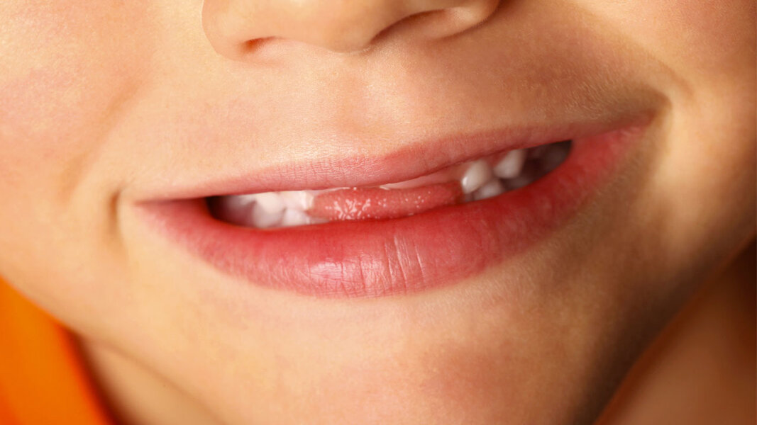 Why Do Some People Have Lisps? Videos Seeker