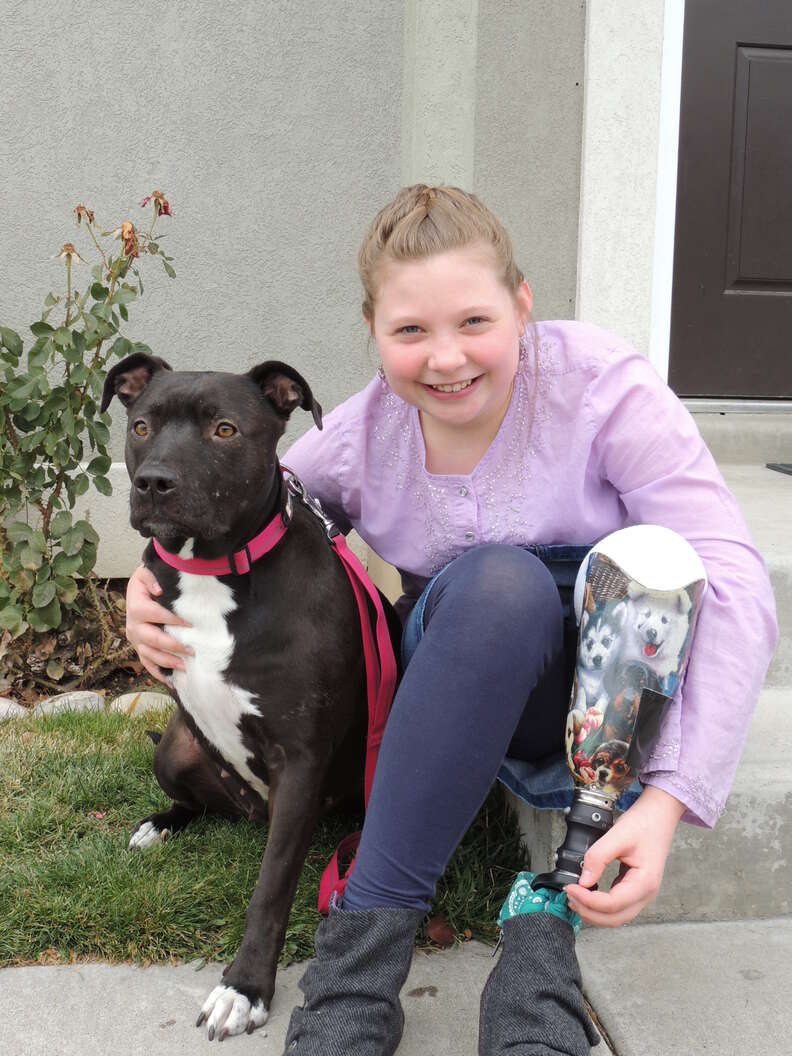little girl who lost a leg gets a three-legged dog