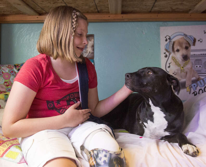 girl who lost a leg gets a dog with three legs