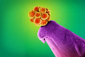 How Your Cells Decide Whether to Be Part of the Brain, or the Colon