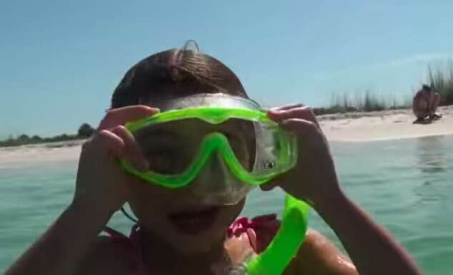 Snorkeler at summer camp who found sea urchin with hair clip