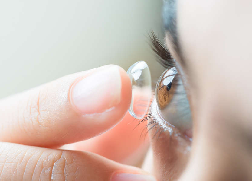 Contact Lens Lost in Eye 28YearOld Lenses Discovered in Woman's Eye