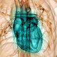 What Can Happen to the Human Heart After Months of Swimming?