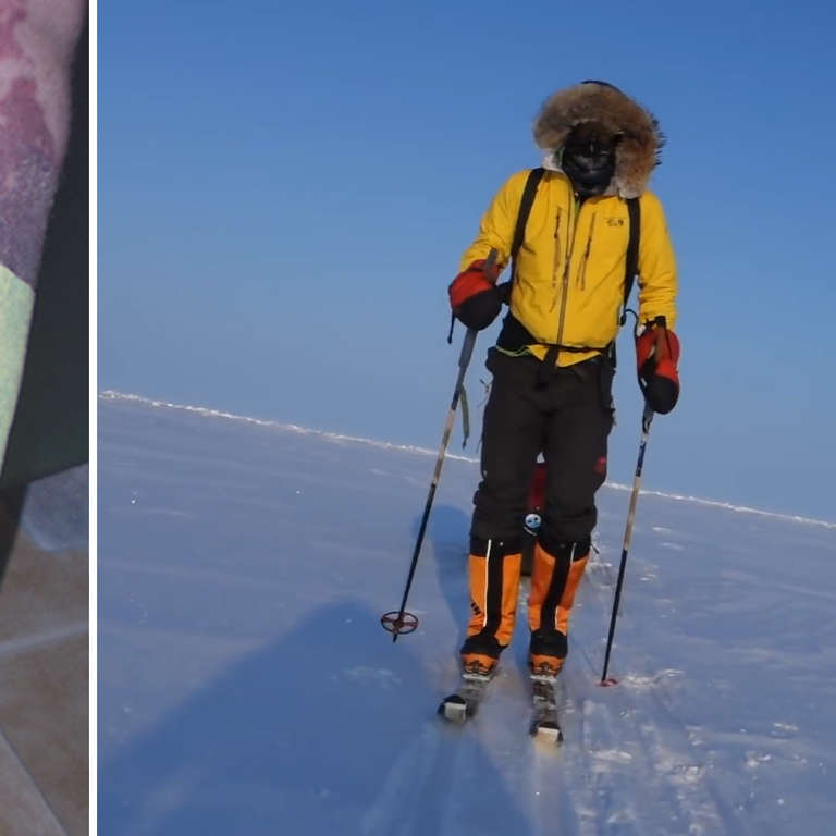 Colin O�Brady Overcame Severe Burns to a Record