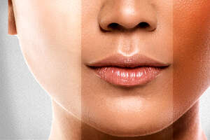 Could Increasing the Melanin In Your Skin Protect You From Cancer? 