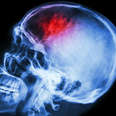 Scientists Are Close To Eliminating Pain, Here’s How