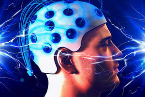 Could Zapping Your Brain With Electricity Improve Your Memory?