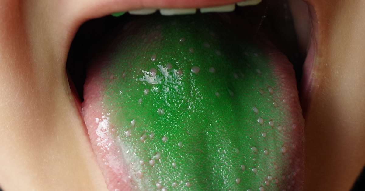 Police Argued A 'Green Film' On Man's Tongue Meant