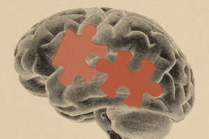 What Does Alzheimer’s Do To the Human Brain?