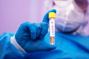 The Race to Test the World for Coronavirus