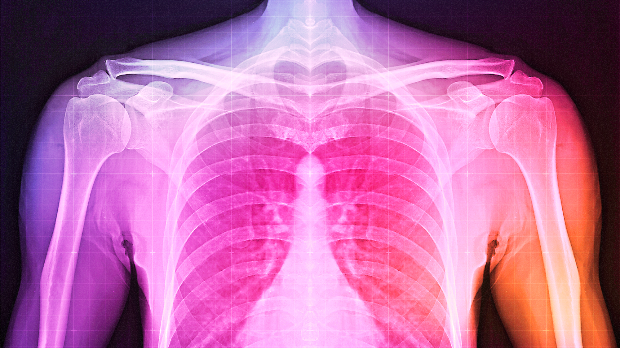 How Exactly Is Your Body Held Together?