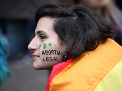 where to get an abortion