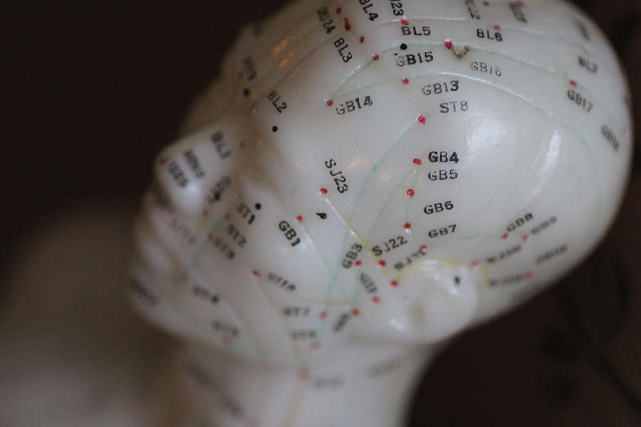 Performance Acupuncture A Bar in Minneapolis, MN Thrillist